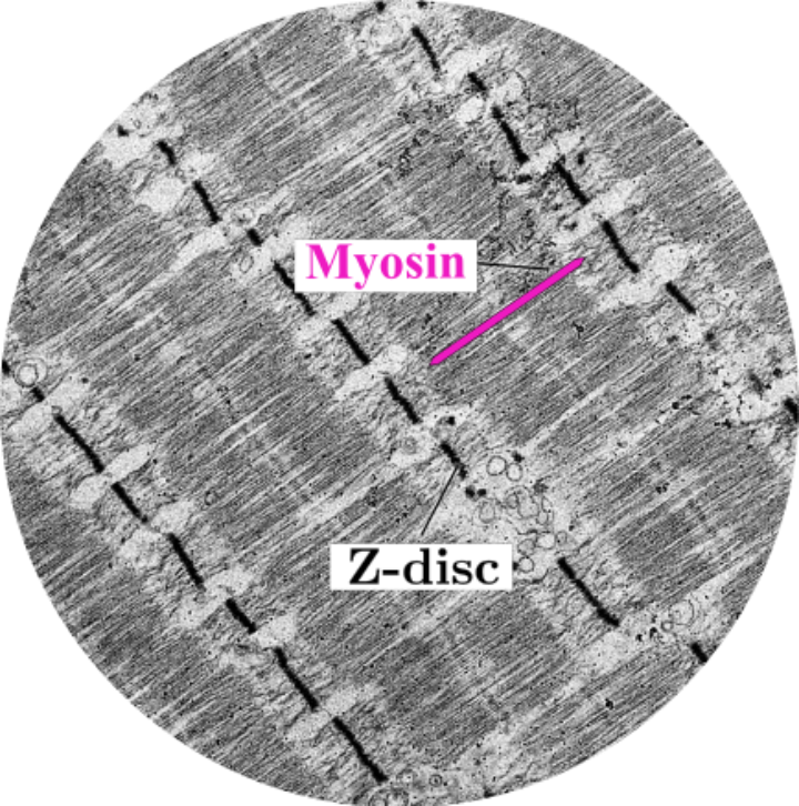 Myosin Z-disc