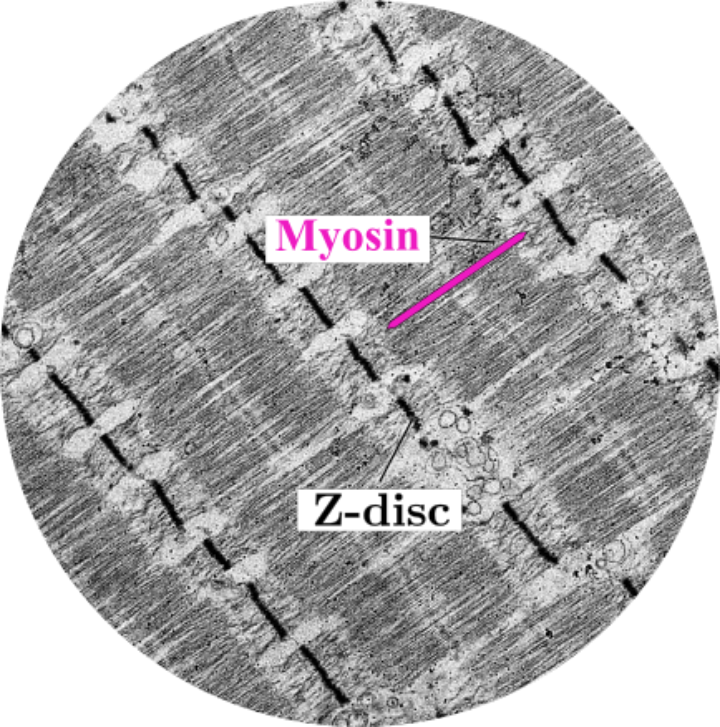 Myosin Z-disc